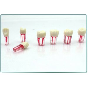 口腔科實習用根管模型牙體牙髓學根管充填窩洞制備