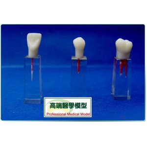口腔科實習用根管模型牙體牙髓學根管充填和窩洞制備