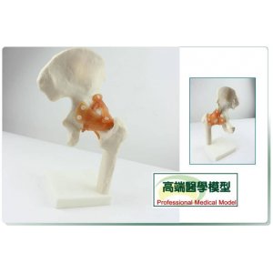 人體髖關節股關節模型人體骨骼模型運動骨骨科疼痛科