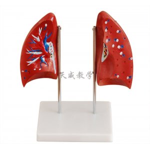 肺部解剖模型,肺部教學模型,肺解剖模型,肺模型